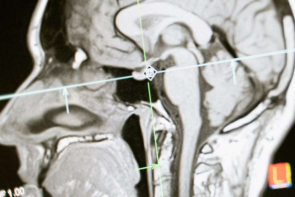 Obraz MRI ludzkiego mózgu z nałożonymi liniami pomiarowymi na ekranie monitora.